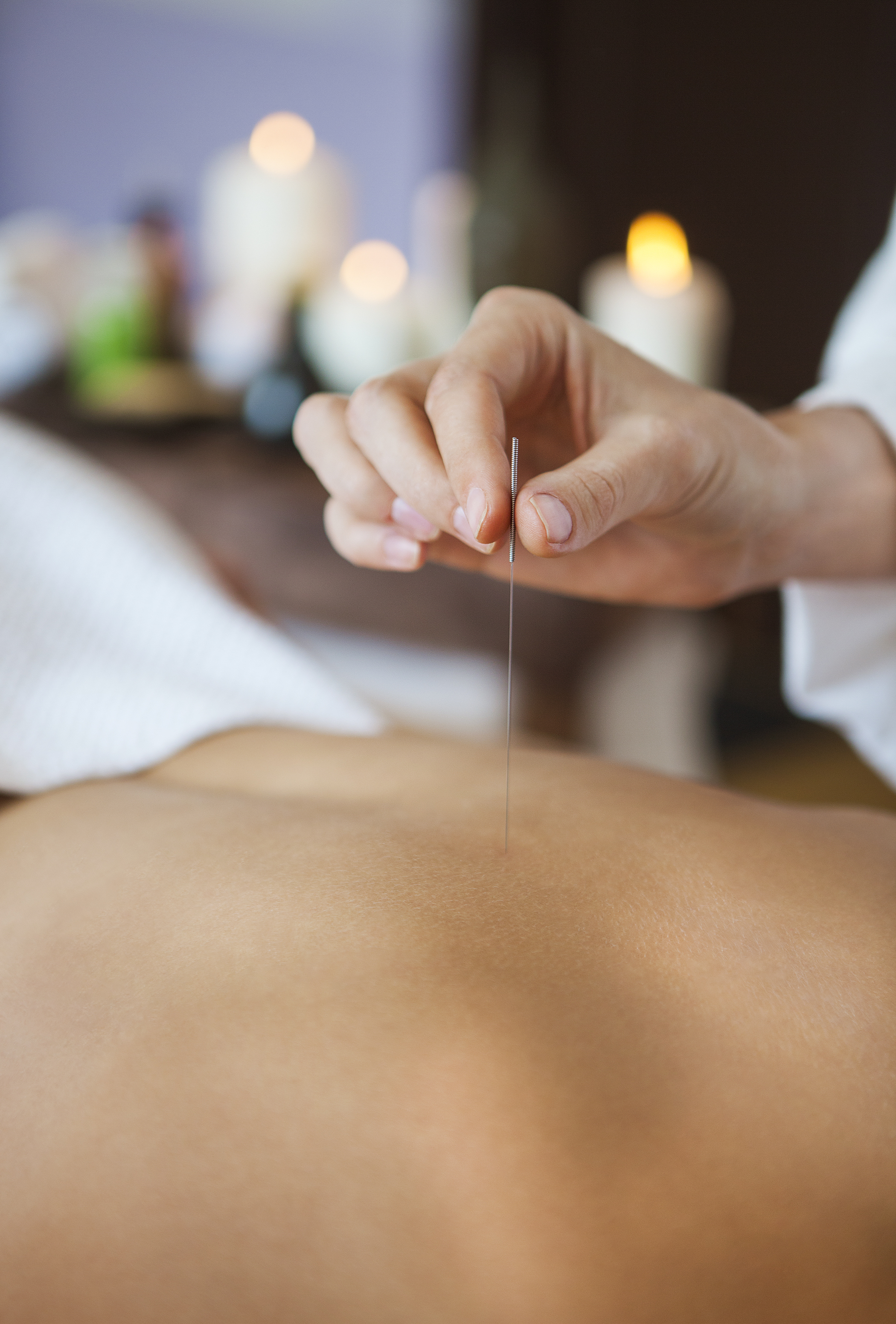 Close up of a hand placing acupuncture needle on back